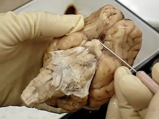Sheep Brain Nerves