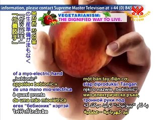 RSLSteeper launches bebionic fully articulating myo electric hand