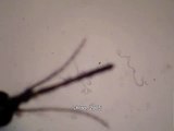 Brugia malayi Filarial Nematode. L3 Larvae from an Infected Mosquito. video.wmv