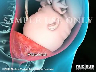 Cesarean Birth Csection