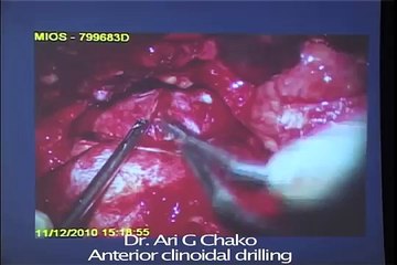 3rd Neurosurgery Skills Training workshop B