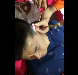 DIY Ear Cleaning (9) Ear Cleaning Relaxation and Stress Relief