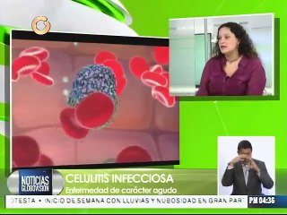 Celulitis infecciosa: enfermedad de carácter agudo
