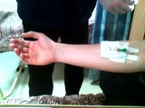 Getting Blood Taken Via Cannula