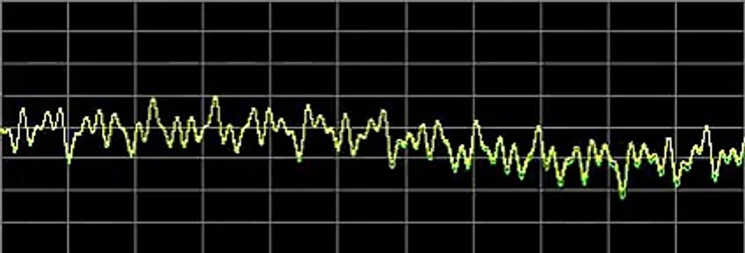 Cellulitis - Rife Frequencies