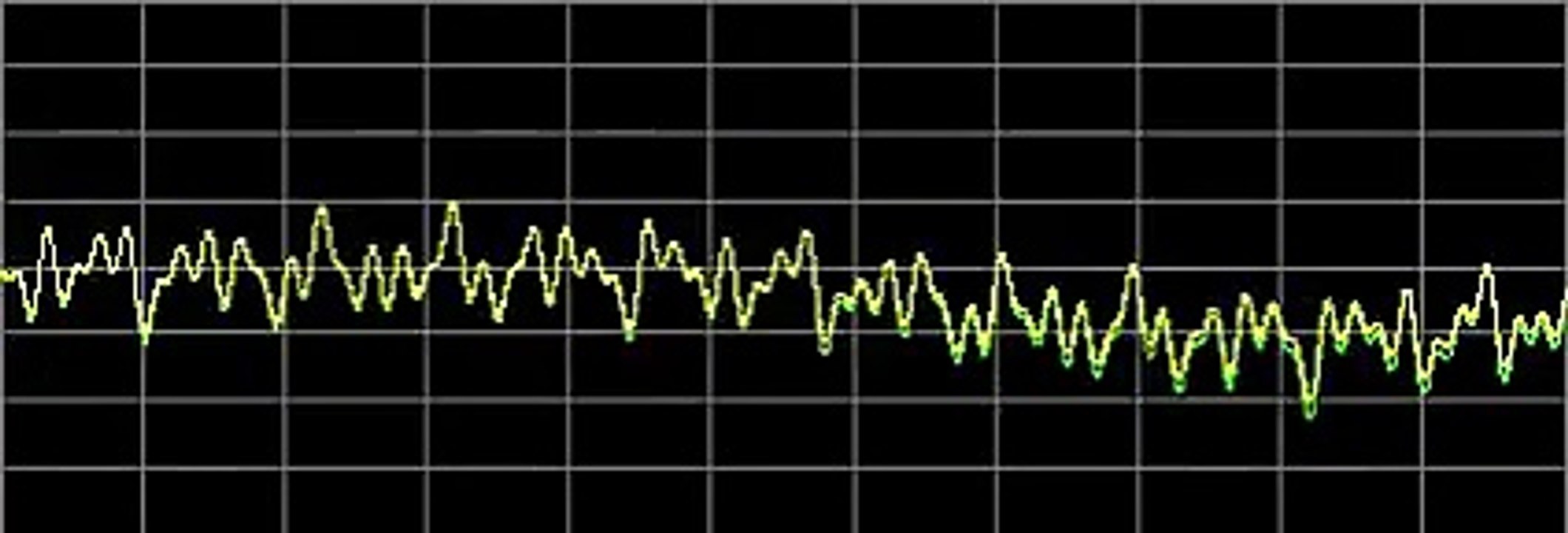 Cellulitis - Rife Frequencies