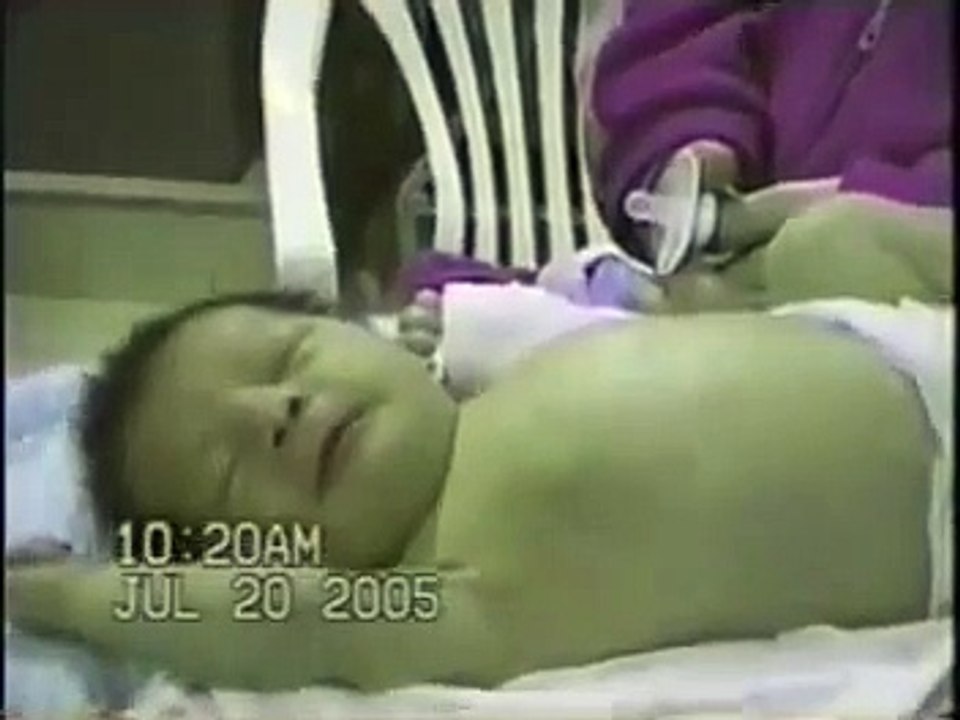 Pediatria * Dificultad Respiratoria 04