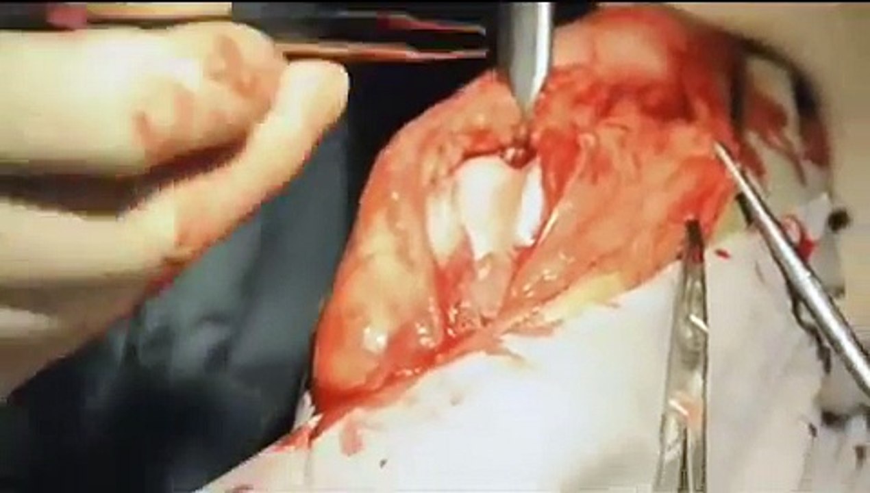 Canine Cruciate Ligament Repair