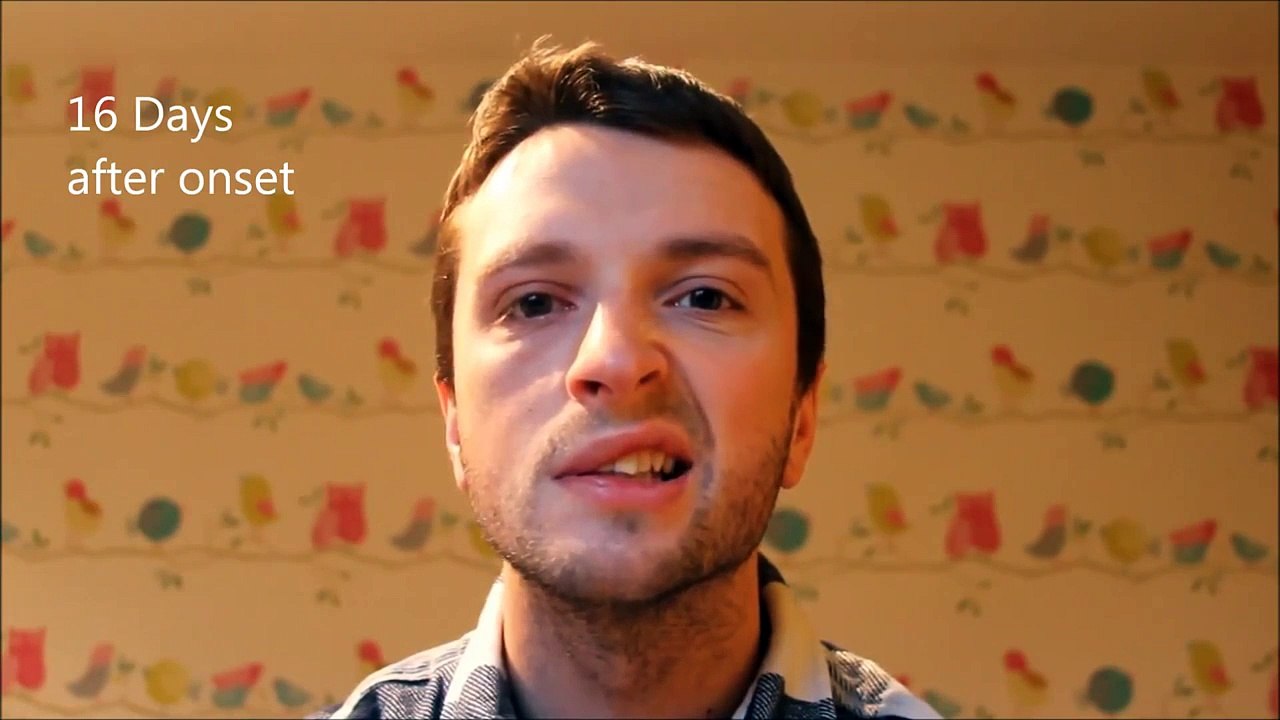Bells Palsy Recovery