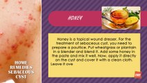 Home Remedies For Sebaceous Cyst Health Tips Cube Films