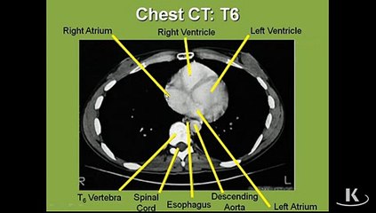 Gross Anatomy Diaphram