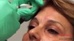 LaserTouch Aesthetics - Botox, Dermal Fillers, Juvederm, Radiesse by Dr Vafa.wmv NYC 212-219-1990
