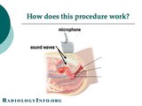 Your Radiologist Explains: Pelvic & Obstetric Ultrasound