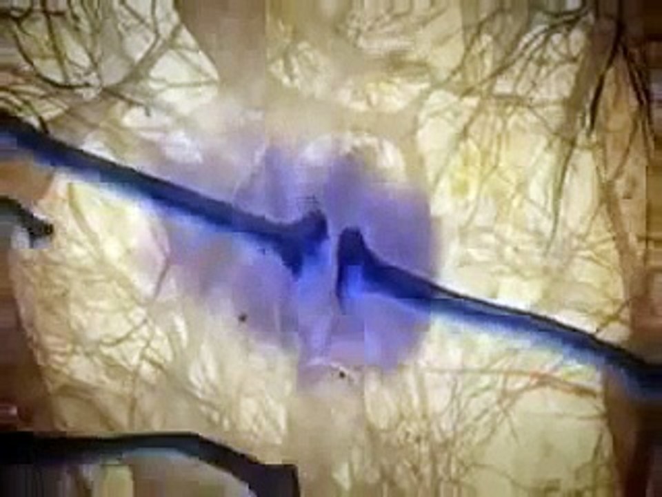 Density of Cannabinoid Receptors in the Brain & Human Body, Areas Where Cannabinoids Like THC "Bind"