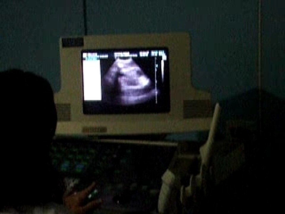 orimera ecografia de alan