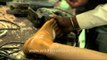 Artificial limbs being made in Jaipur - India