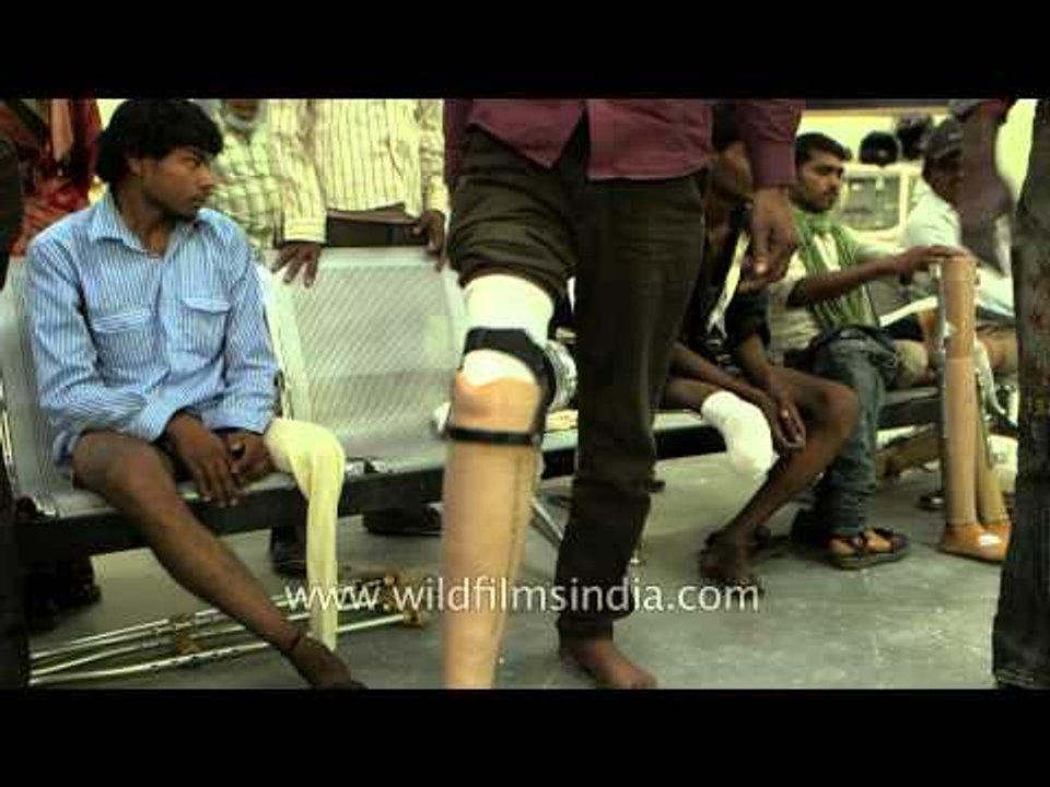 Patient fitting an artificial limb, Jaipur