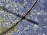 Algae microscopic exam Oscillatoria, Pediastrum, Anacystis, Euglena. 400x Phase Contrast
