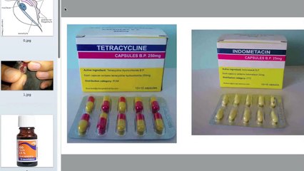 Canker/Trichomoniasis   نەخۆشی کانکەر/دانکە بۆ کۆتر