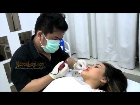 Bibir Pucat dan Kering Felly Chibi Pilih Sulam Bibir Kristal