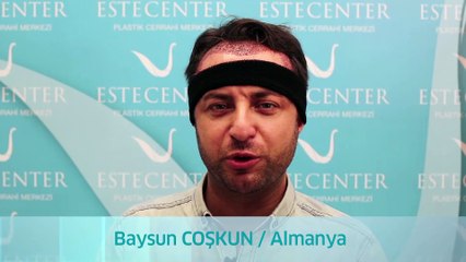 Saç Ektiren Hasta Yorumları - Baysun Coşkun