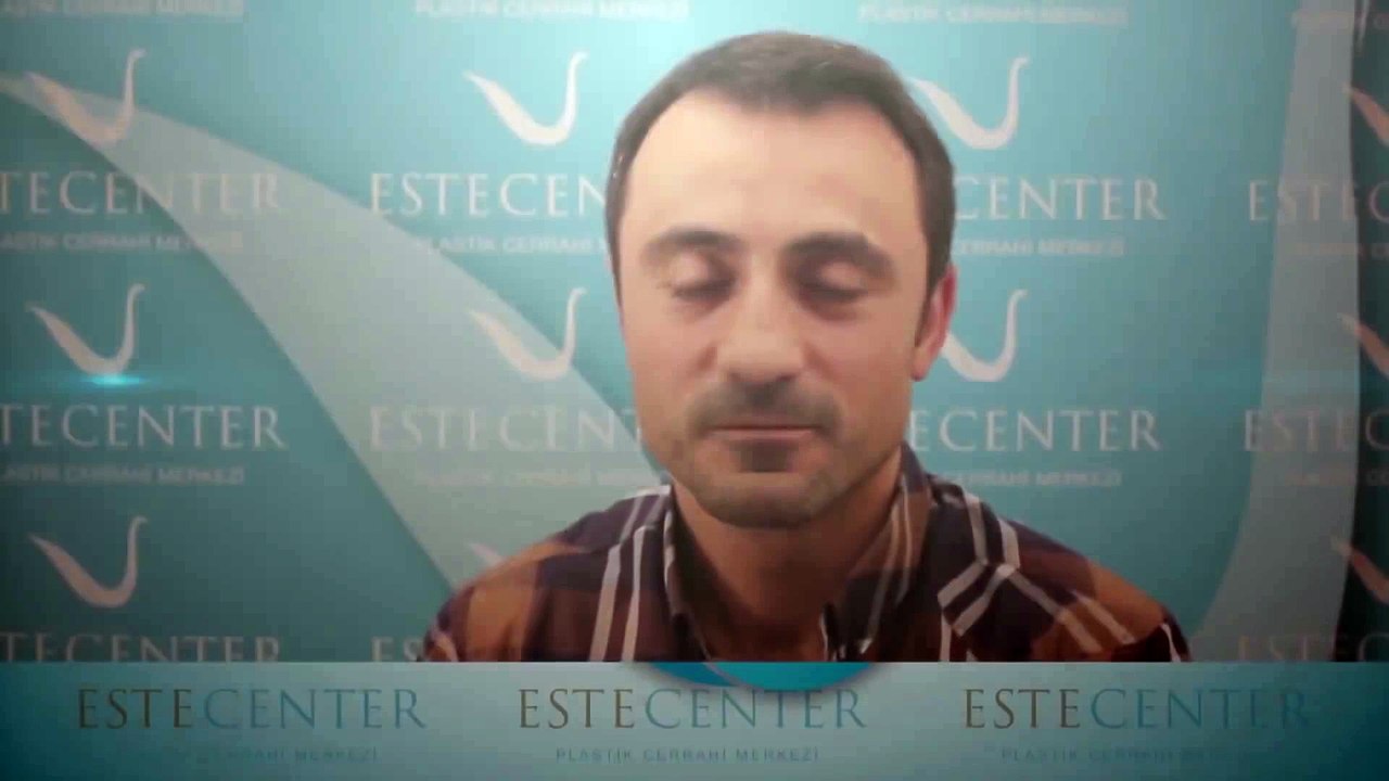 Saç Ektiren Hasta Yorumları - Mustafa Yumbul