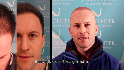 Saç Ektiren Hasta Yorumları - Nafiz Yılmaz