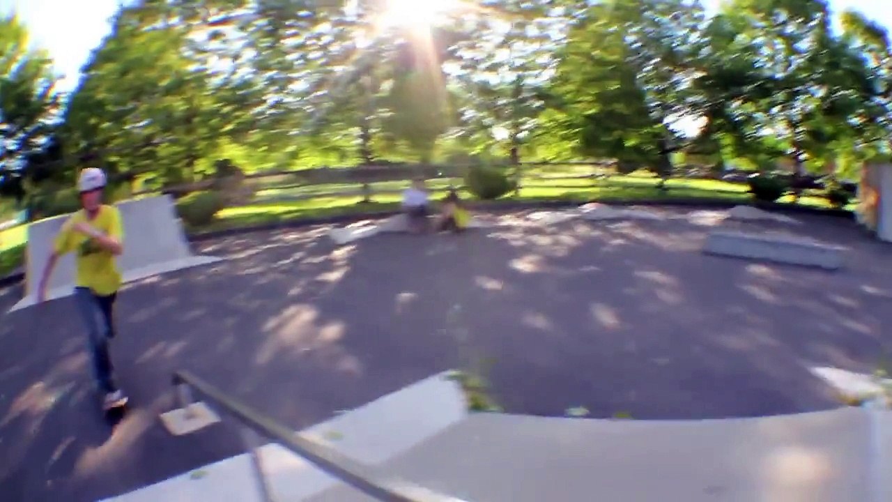 Zac breaks his ankle