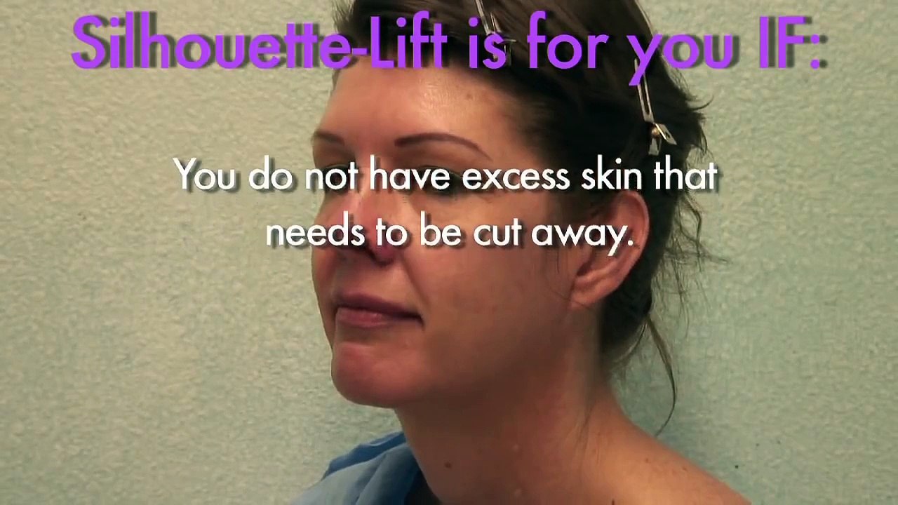 Silhouette face lift : Non invasive face lift