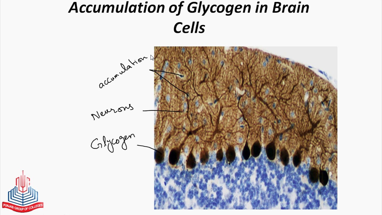 Tay Sach's Disease , Per oxisomes