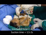 Neonatal Resuscitation. Meconium Aspiration and Digital Intubation