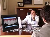 Estética dental: dientes manchados (problema y solución)