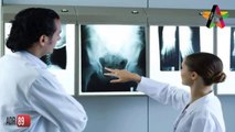 Los Objetos más insólitos encontrados en una Radiografía