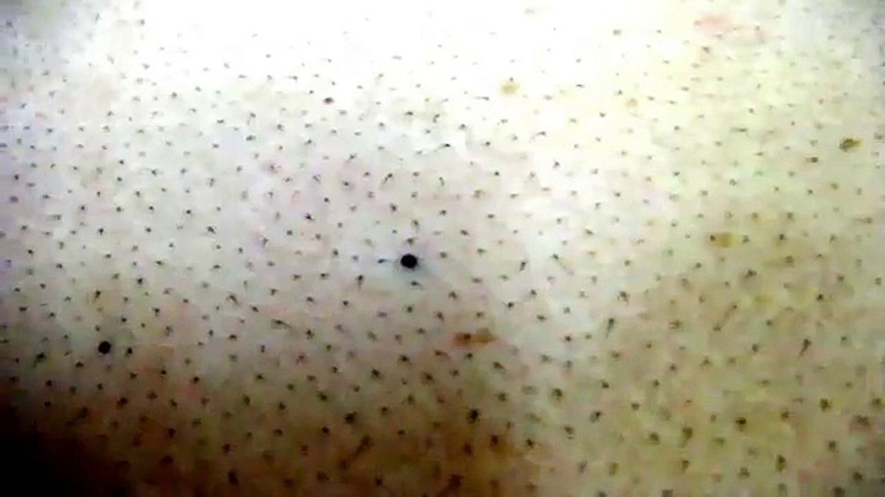 KEÇİÖREN BAXI KOMBİ SERV.0312-279-15-16