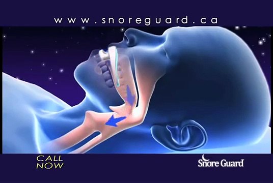 Snore Guard Reviews Stop Snoring Mouthpiece