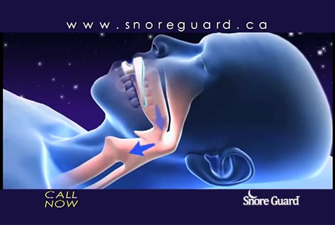 Snore Guard Reviews Stop Snoring Mouthpiece