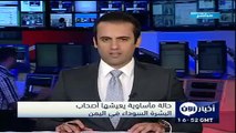حالة مأساوية يعيشها أصحاب البشرة السوداء في اليمن