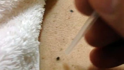 MAMAK BUHARA KOMBİ SERV. 0312-279-15-16