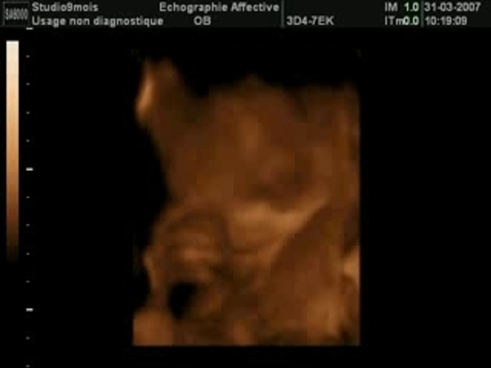 BEBE2_43_LIVE