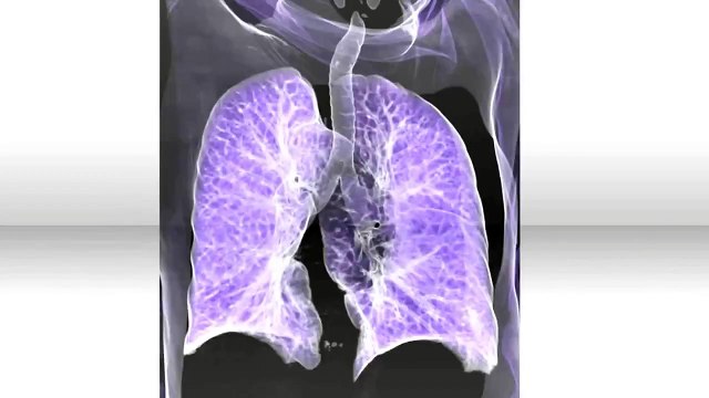 How Does an MTI Work? | environmental science projects, | gcse biology experiments