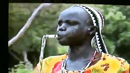 Dinka Man is so fat his tummy explodes