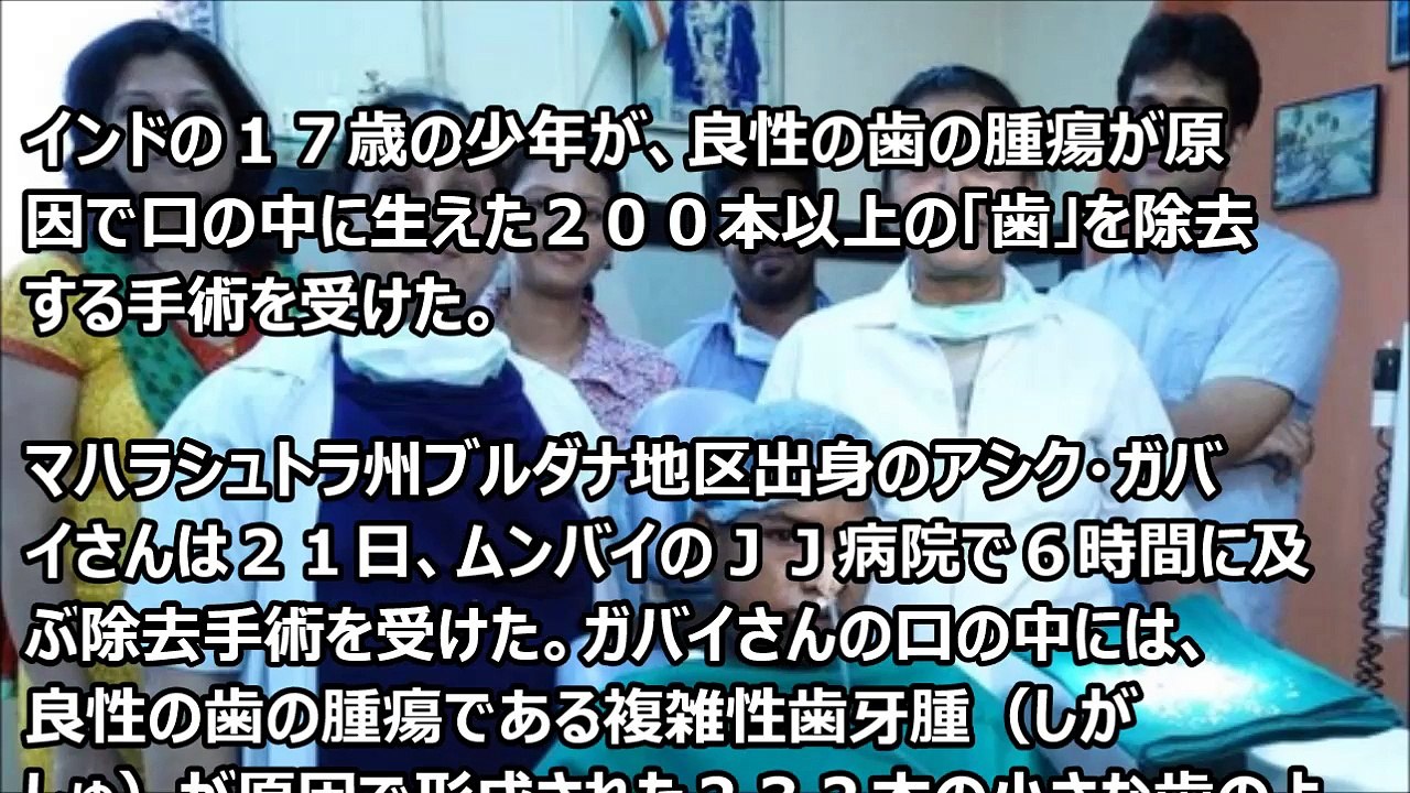 【閲覧注意】インドの少年から232本の歯を摘出