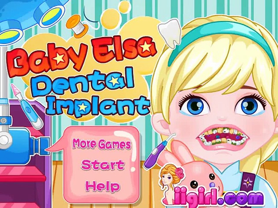 ▐ ╠╣Đ▐► Baby Elsa Dental Implant Game - Frozen Elsa at the dentist game