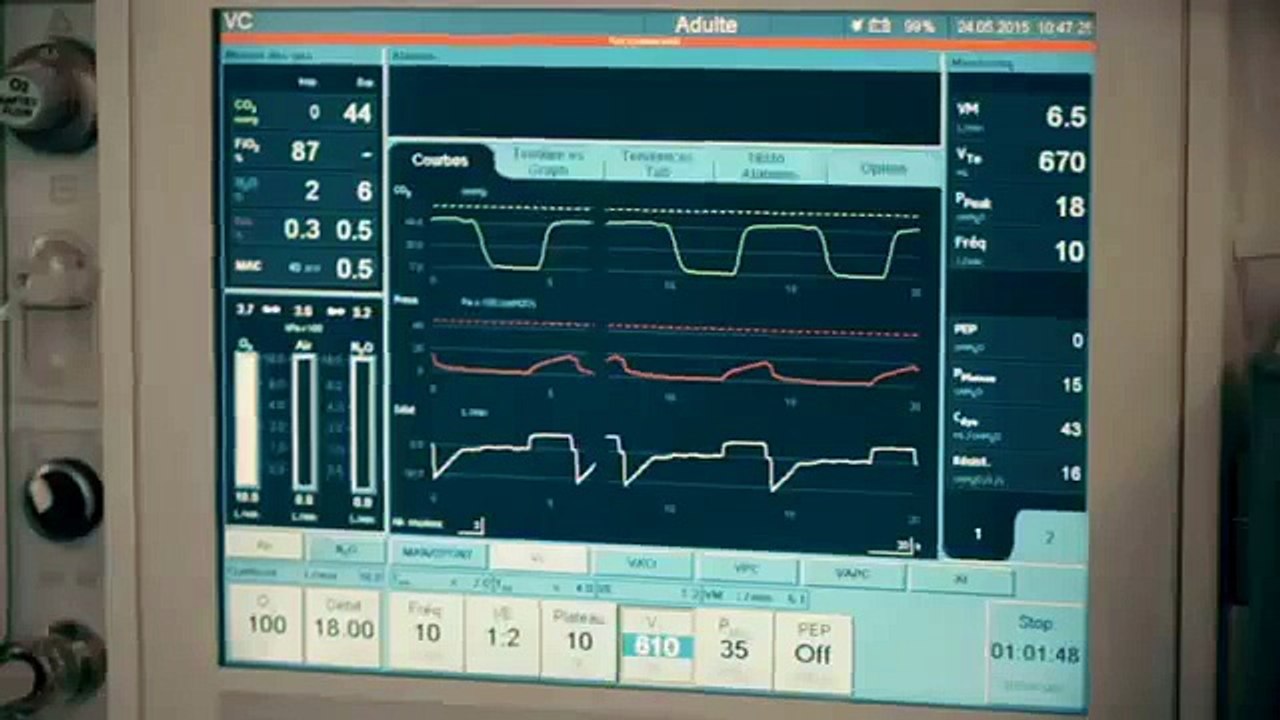 ليلة الشك الحلقة الرابعة الجزء 01