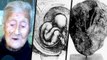 Mummified Fetus In 92-Year Old Chilean Grandma | Shocking