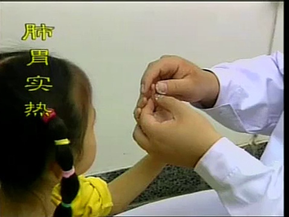 DIY 几种常见病的推拿治疗 (43) 治疗肺胃实热