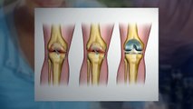 Orthopedic Surgeon Frisco TX _ Call Today 469-293-4000