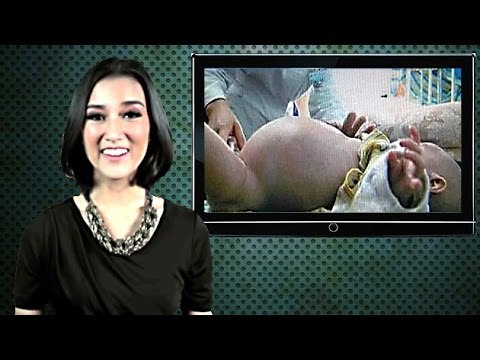 2 Year Old Gives Birth To Own Twin!