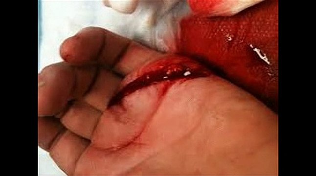 Thumbnail