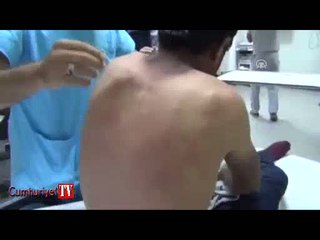 Koyun otlatırken doludan yaralandılar